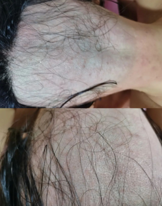 被“剃頭”的女性們：遭騙剃光后腦勺，維權牽出一條迎合怪癖產業鏈
